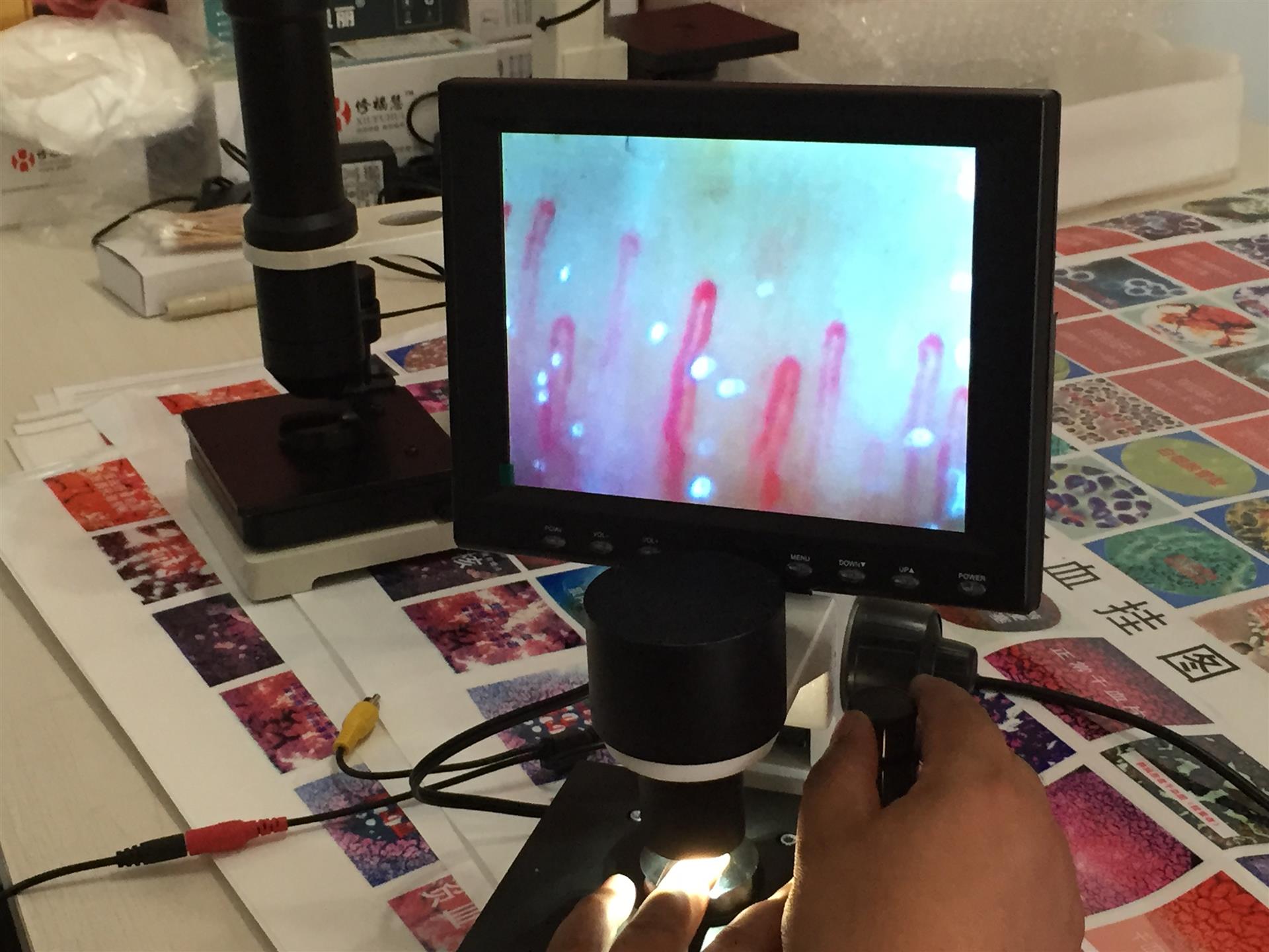 高清甲壁微循环检测仪